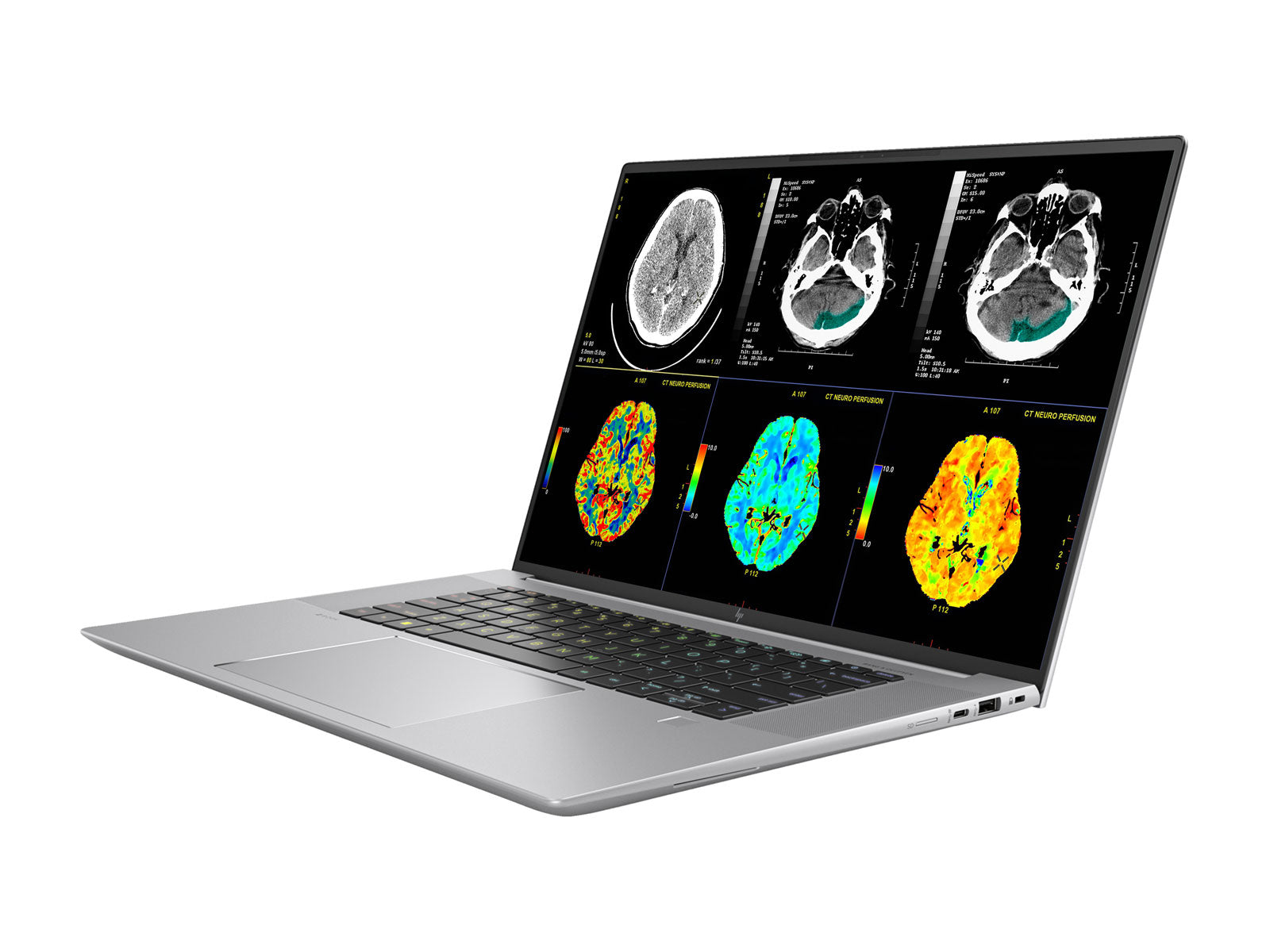 HP ZBook Studio 16 G10 Mobile Radiology Workstation | 16" WUXGA DICOM Calibrated | Core i9-13900H @ 5.4GHz | 64GB DDR5 | 1TB NVMe SSD | NVIDIA RTX 4070 8GB | WiFi 6E