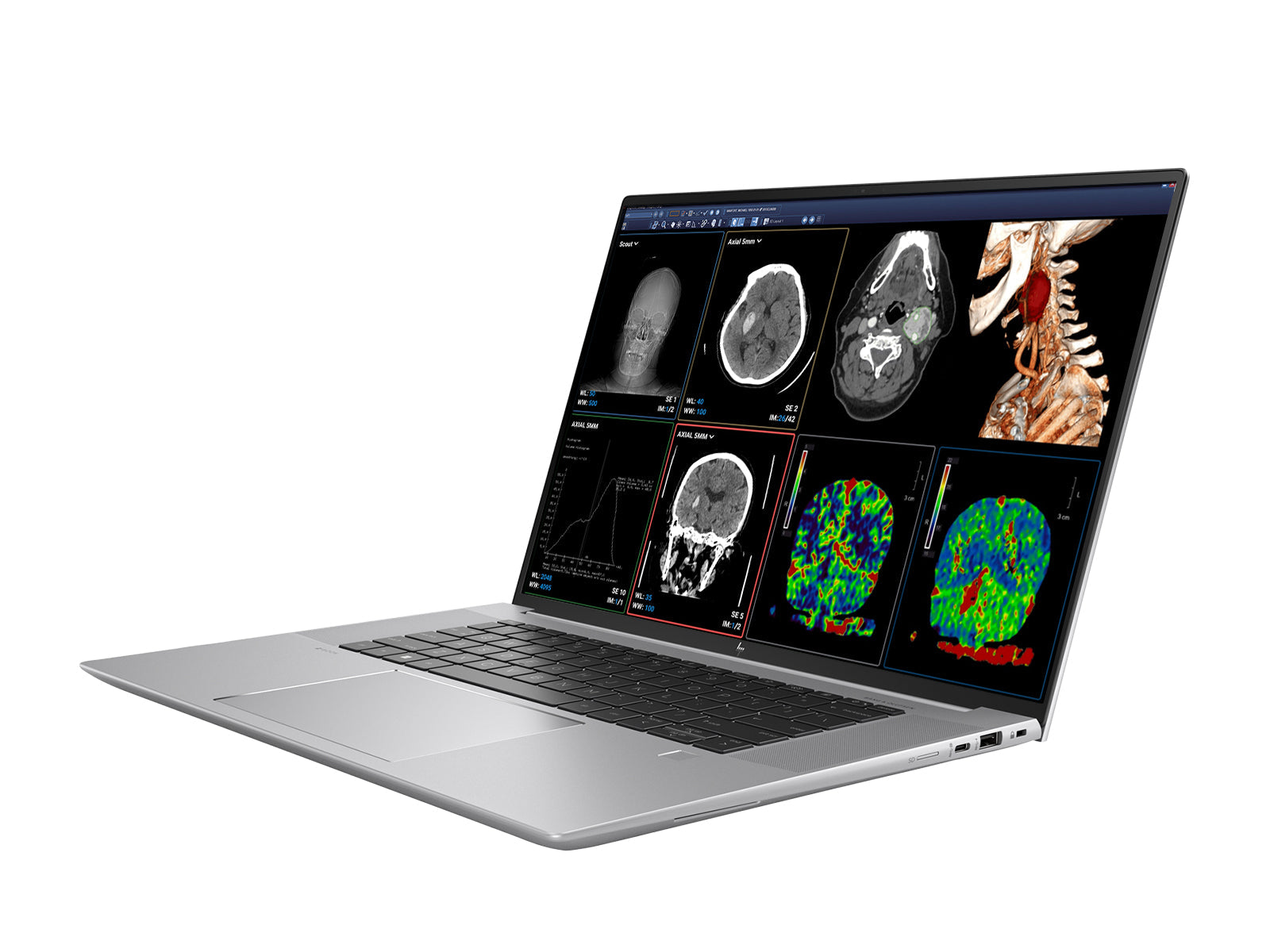 HP ZBook Studio 16 G9 Mobile Radiology Workstation | 16" 9MP 4K UHD DICOM Calibrated | Core i9-12900H @ 5.00GHz | 64GB DDR5 | 1TB NVMe SSD | Nvidia RTX A1000 4GB| Win11 Pro