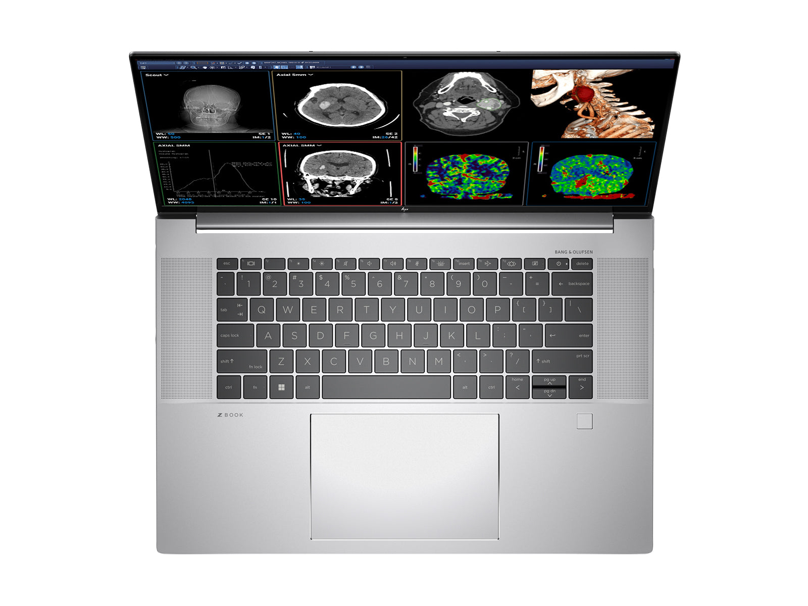 HP ZBook Studio 16 G9 Mobile Radiology Workstation | 16" 8MP 4K UHD DICOM Calibrated | Core i7-12700H @ 4.80GHz | 64GB DDR5 | 1TB NVMe SSD | Nvidia RTX A1000 4GB | Win11 Pro