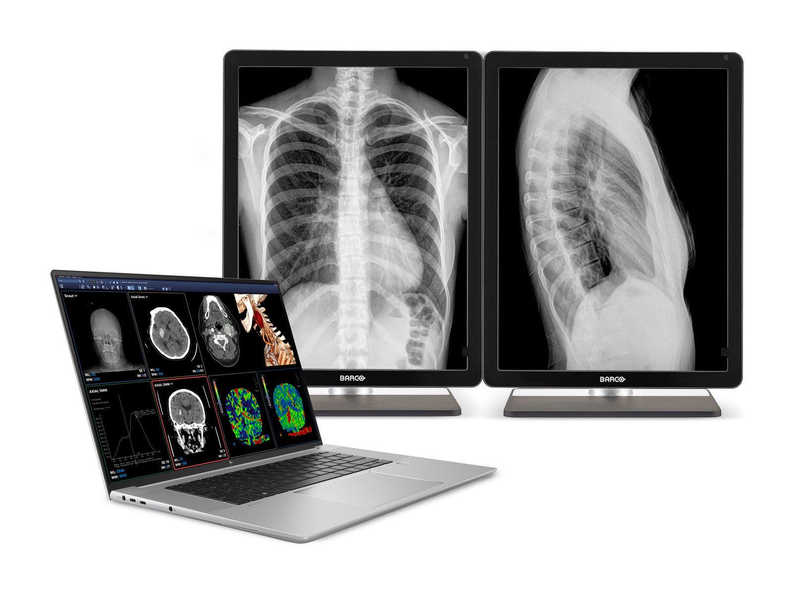 HP ZBook Studio 16 G9 Mobile Radiology Workstation | 16" 9MP 4K UHD DICOM Calibrated | Core i9-12900H @ 5.00GHz | 64GB DDR5 | 1TB NVMe SSD | Nvidia RTX A1000 4GB| Win11 Pro