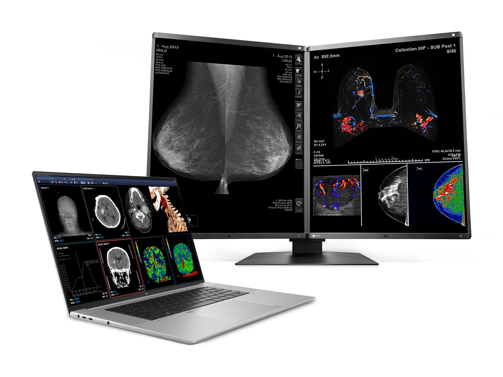 HP ZBook Studio 16 G9 Mobile Radiology Workstation | 16" 9MP 4K UHD DICOM Calibrated | Core i9-12900H @ 5.00GHz | 64GB DDR5 | 1TB NVMe SSD | Nvidia RTX A1000 4GB| Win11 Pro