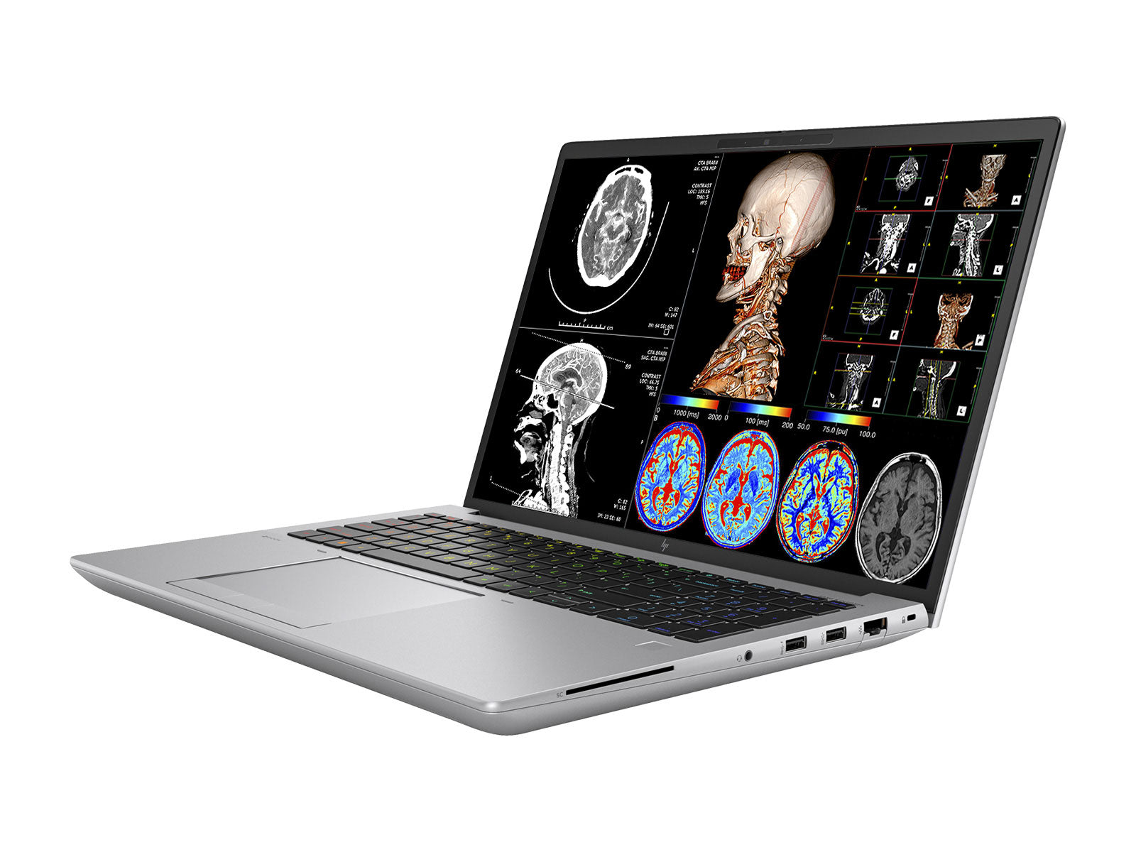 HP ZBook Fury 16 G9 Mobile Radiology Workstation | 16" WUXGA DICOM Calibrated | Core i7-12800HX @ 4.80GHz | 16-core | 128GB DDR5 | 1TB NVMe SSD | Radeon Pro W6600M 8GB | WiFi 6