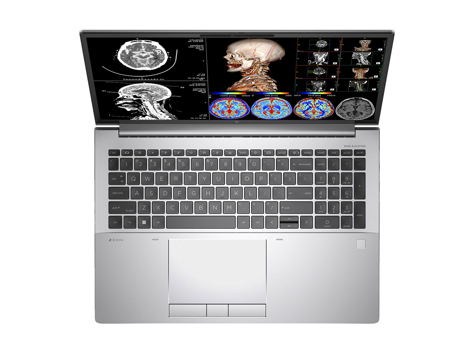 HP ZBook Fury 16 G9 Mobile Radiology Workstation | 16" WUXGA DICOM Calibrated | Core i7-12800HX @ 4.80GHz | 16-core | 128GB DDR5 | 1TB NVMe SSD | Radeon Pro W6600M 8GB | WiFi 6