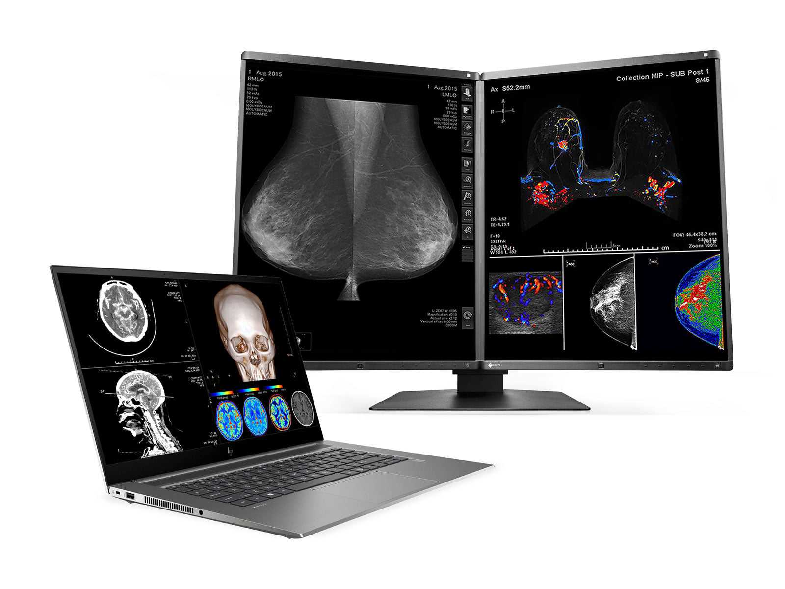 HP ZBook Studio 15 G8 Mobile Radiology Workstation | 15.6" OLED 8MP+DICOM Calibrated | Core i7-11800H @ 4.60GHz | 32GB DDR4 | 512GB NVMe SSD | Nvidia RTX 3060 6GB | Win11 Pro Monitors.com 