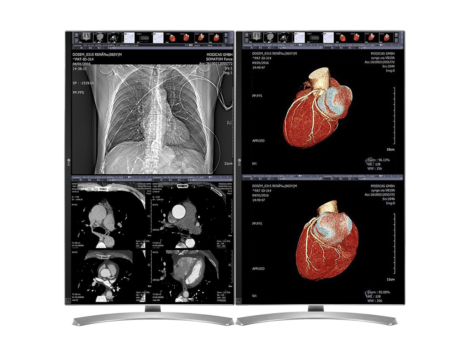 LG 27" 8MP Color Clinical Review Medical Display Monitor (27M-W) Monitors.com 