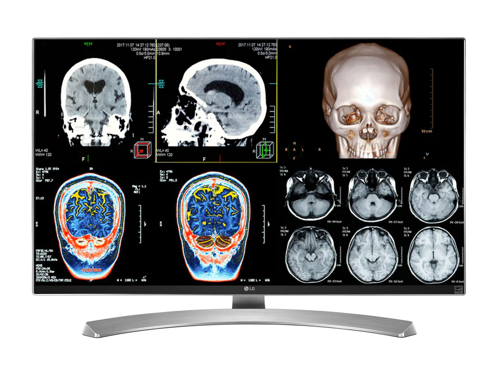 Complete Clinical Review Reading Station | 2 x LG 27" 8MP Color Clinical Review Displays | HP ZBook Studio 16 G10 | Dictation Mic | PerfectLUM Calibration Package (LGHP16G10)