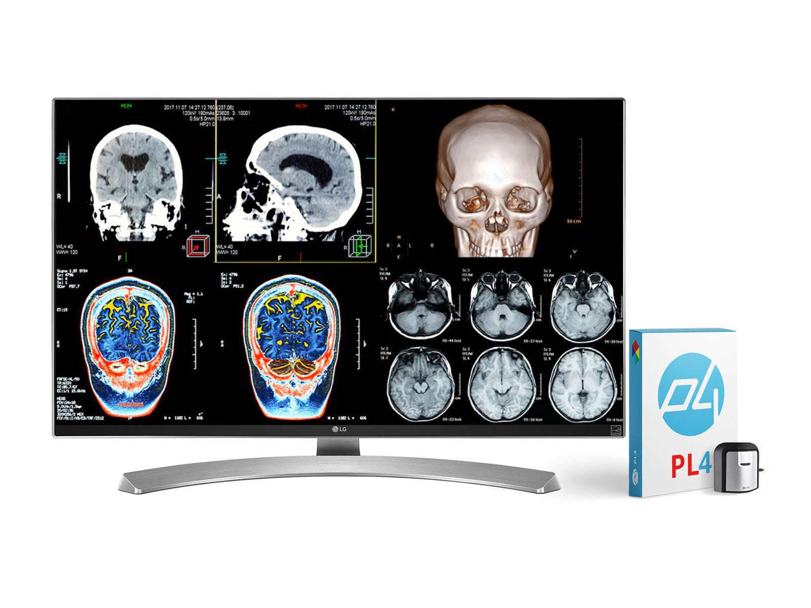 Complete Clinical Review Reading Station | 2 x LG 27" 8MP Color Clinical Review Displays | HP ZBook Studio 16 G10 | Dictation Mic | PerfectLUM Calibration Package (LGHP16G10)