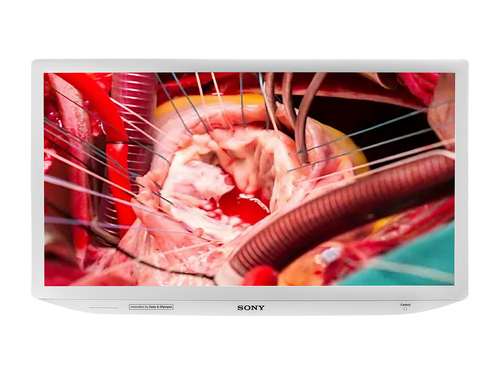 Sony LMD-X310S 31" LCD 4K 3D Color Surgical Medical Display Monitor (LMD-X310S)