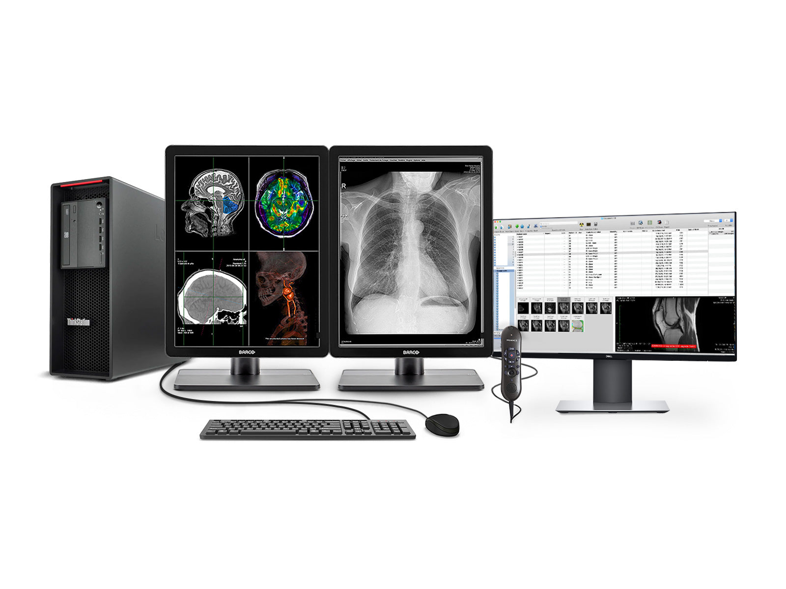 Pacs General Radiology Station | Barco 3MP 색상 LED 디스플레이 | HP 워크 스테이션 | 독립 마이크 | 워크리스트 모니터 (3321Z4R)