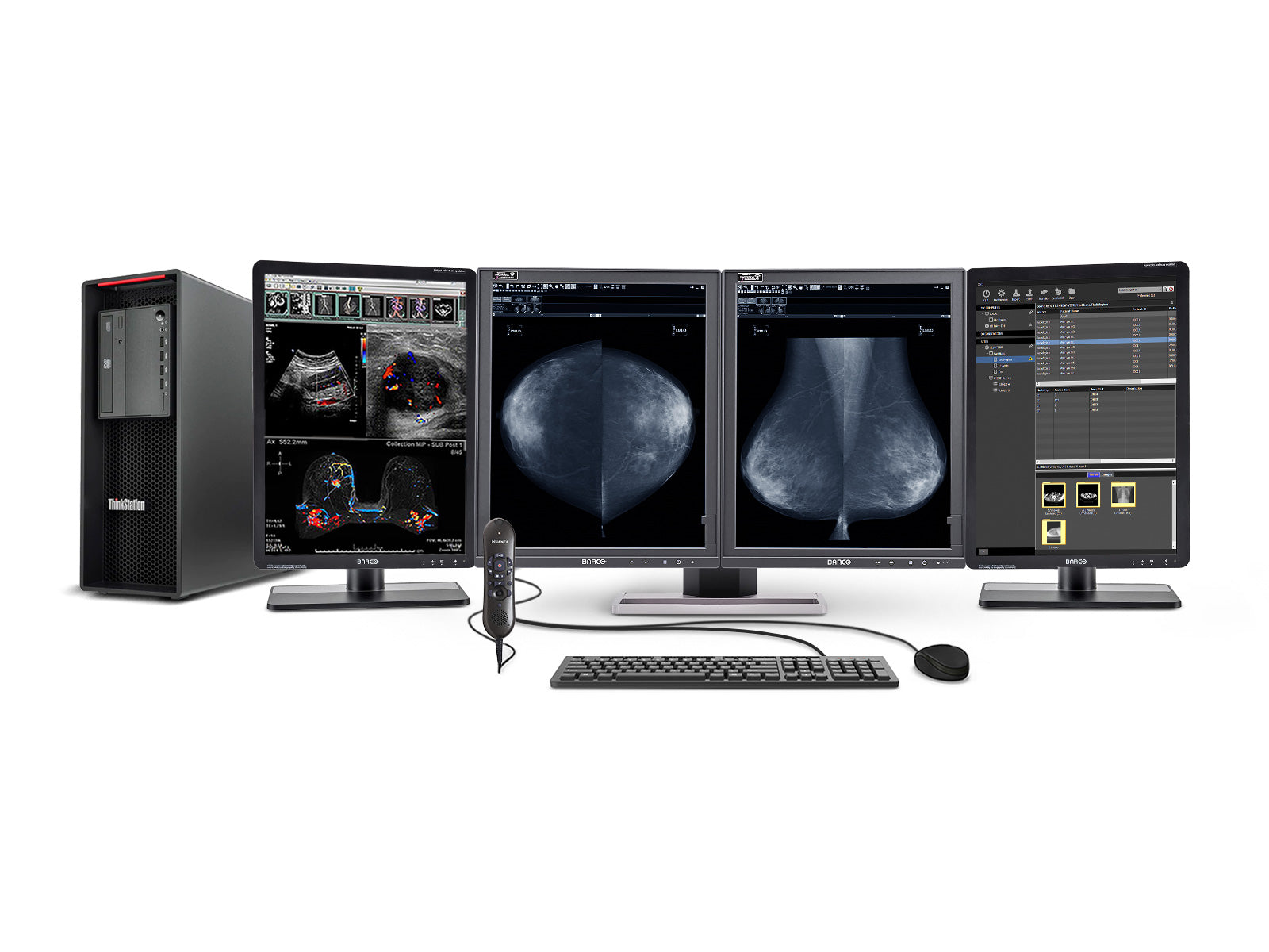 Complete Mammography Reading Station | Barco 5MP Grayscale LED Monitor | Lenovo Workstation | Dictation Mic | Worklist Monitors (5221Z42221)