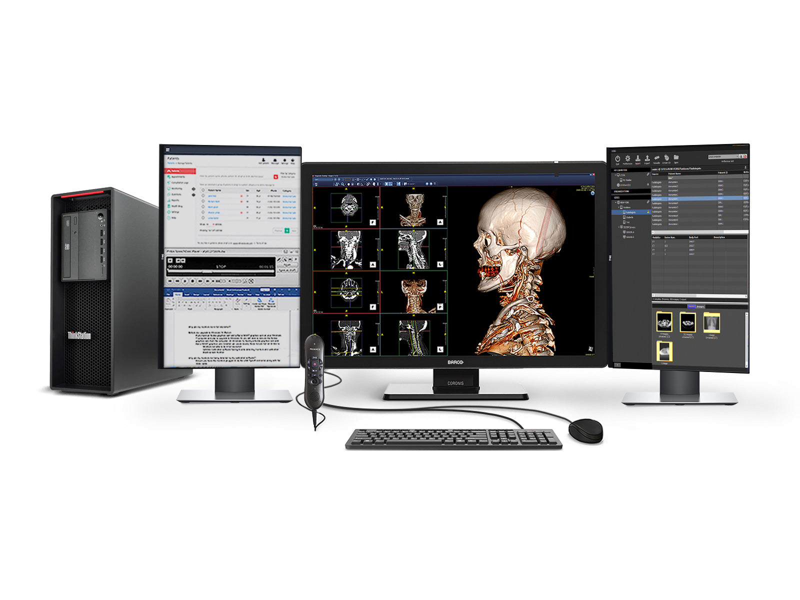 Complete PACS General Radiology Station | Lenovo Workstation