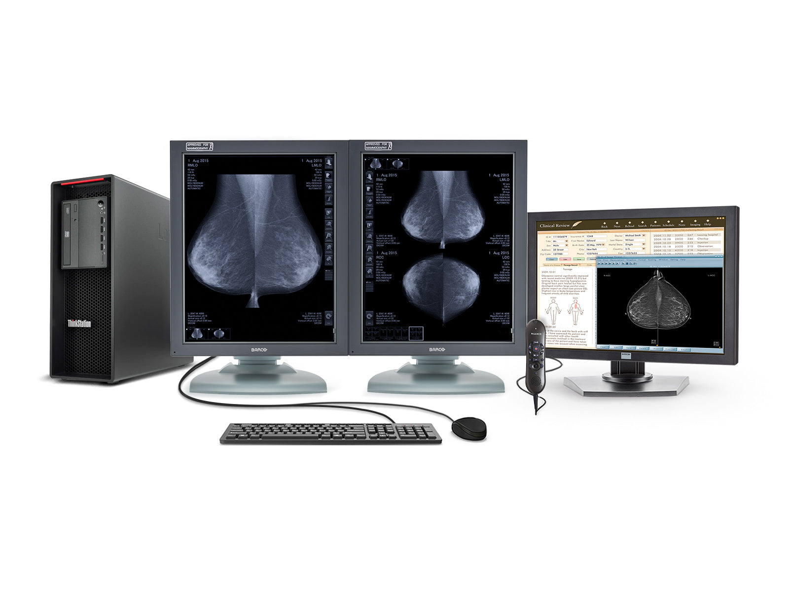 Complete PACS Mammography Reading Station | Barco 5MP Grayscale Displays | Lenovo Workstation | Dictation Mic | Worklist Monitor (MG5121Z4R)