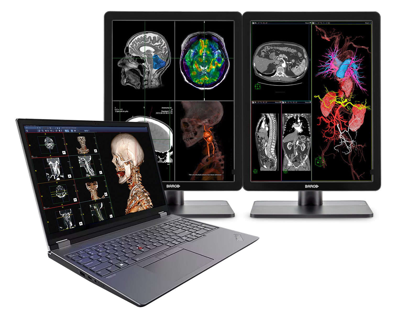 Lenovo ThinkPad P16 Mobile Radiology Workstation | 8MP+ UHD DICOM 600nits 16" Display | Intel Core i9-12900HX @ 5.0GHz | 64GB DDR5 | 1TB NVMe SSD | RTX A4500 16GB | Win10-11 Pro Monitors.com 