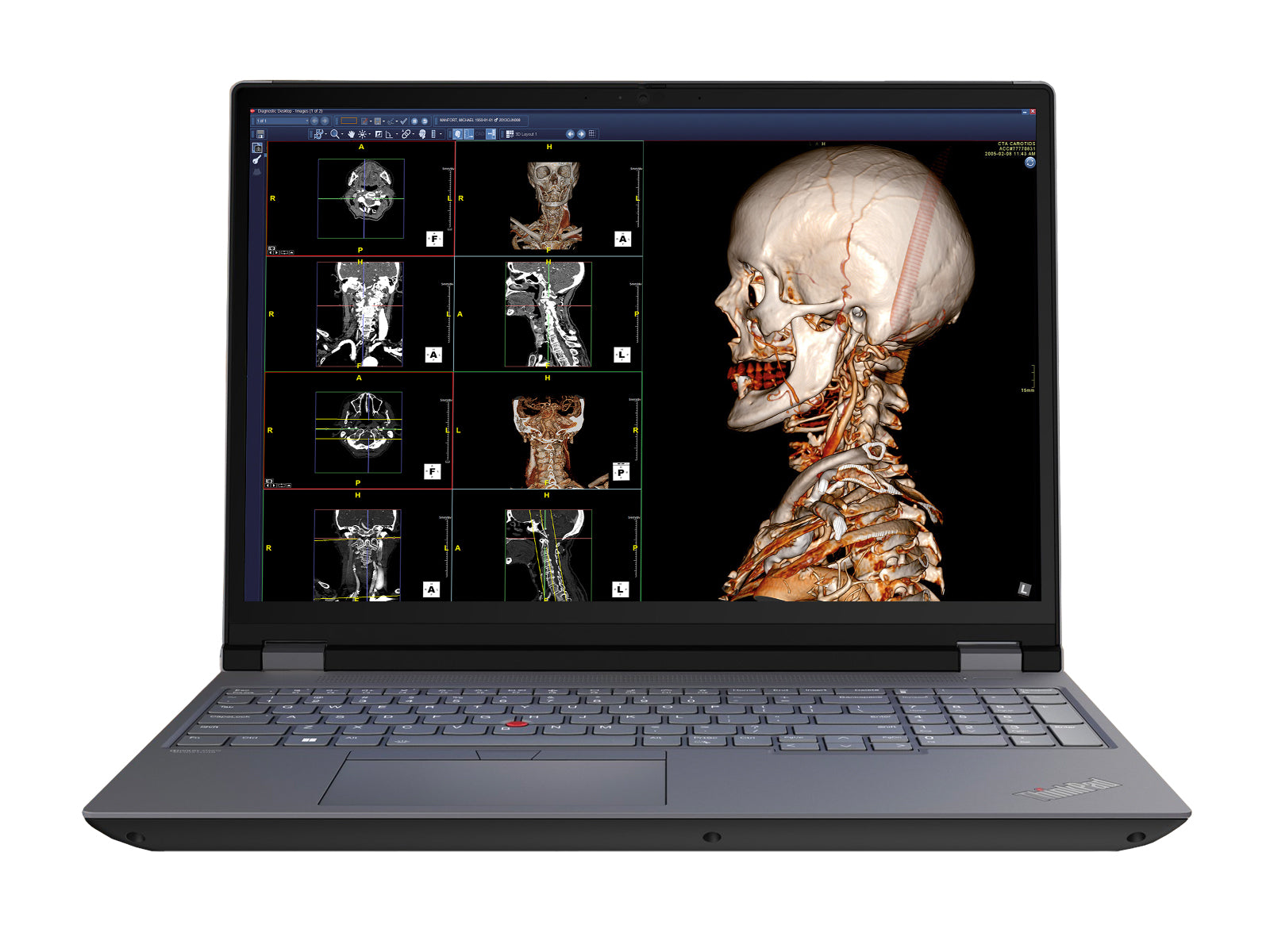 Lenovo ThinkPad P16 Mobile Radiology Workstation | 8MP+ UHD DICOM 600nits 16" Display | Intel Core i9-12900HX @ 5.0GHz | 128GB DDR5 | 1TB NVMe SSD | RTX A4500 16GB | Win10-11 Pro Monitors.com 