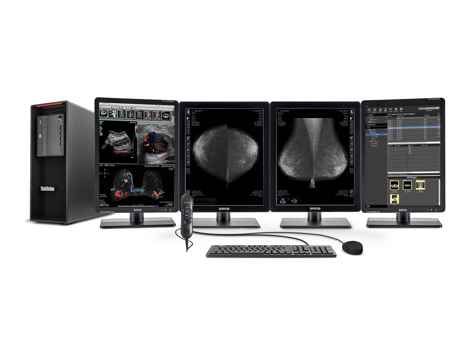 Complete Mammography Reading Station | Lenovo Workstation