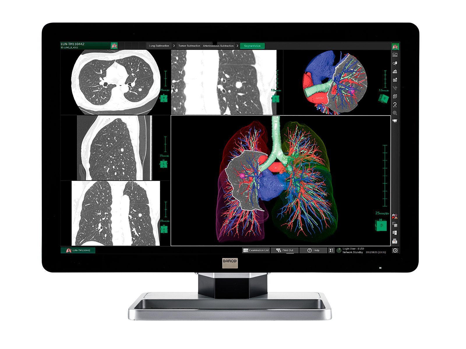 Complete PACS General Radiology Station | Barco 6MP Color LCD Display | Lenovo Workstation | Dictation Mic | Worklist Monitor (6130Z4)