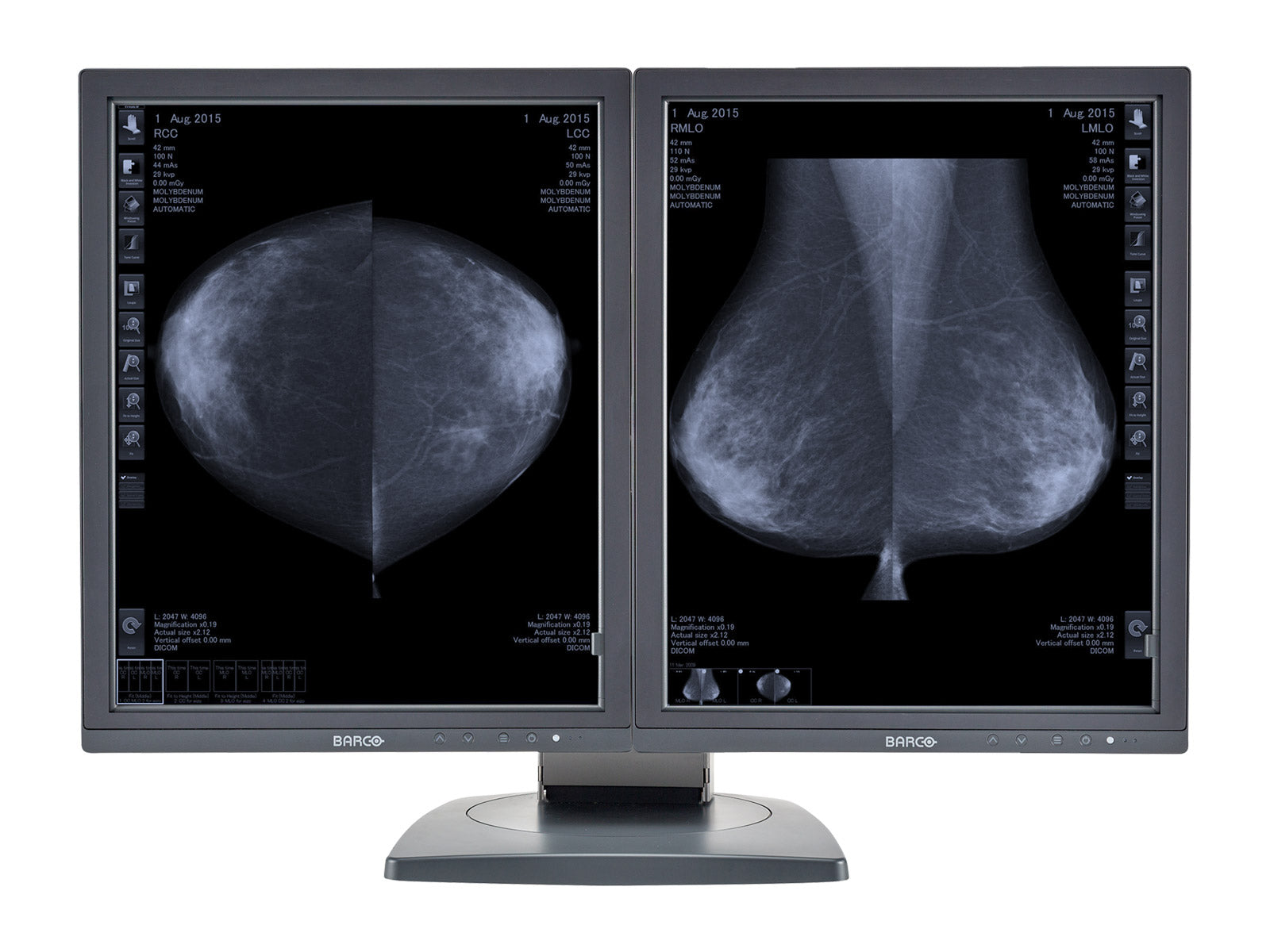 Complete Mammography Reading Station | Barco 5MP Grayscale 3D-DBT Displays | HP Workstation | Dictation Mic | Worklist Monitor (MD5121Z4R) Monitors.com 