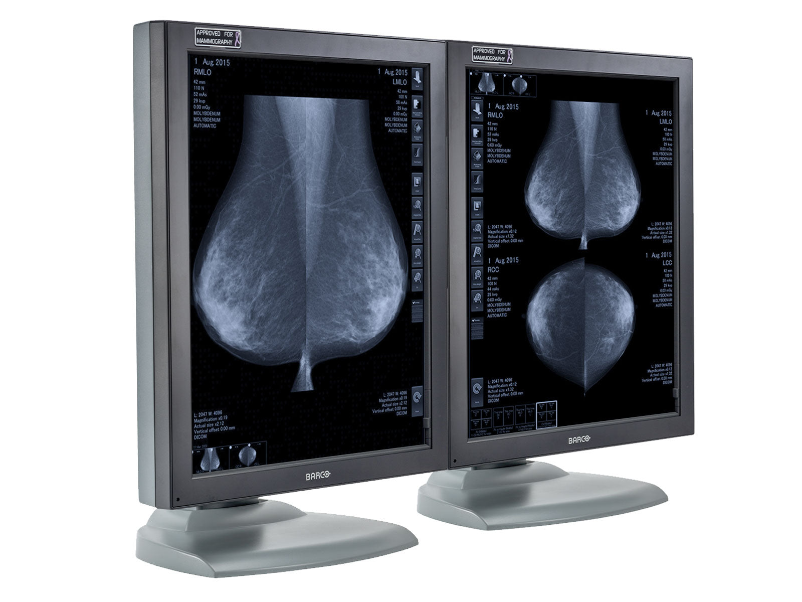 Complete PACS Mammography Reading Station | Barco 5MP Grayscale Displays | Lenovo Workstation | Dictation Mic | Worklist Monitor (MG5121Z4R)