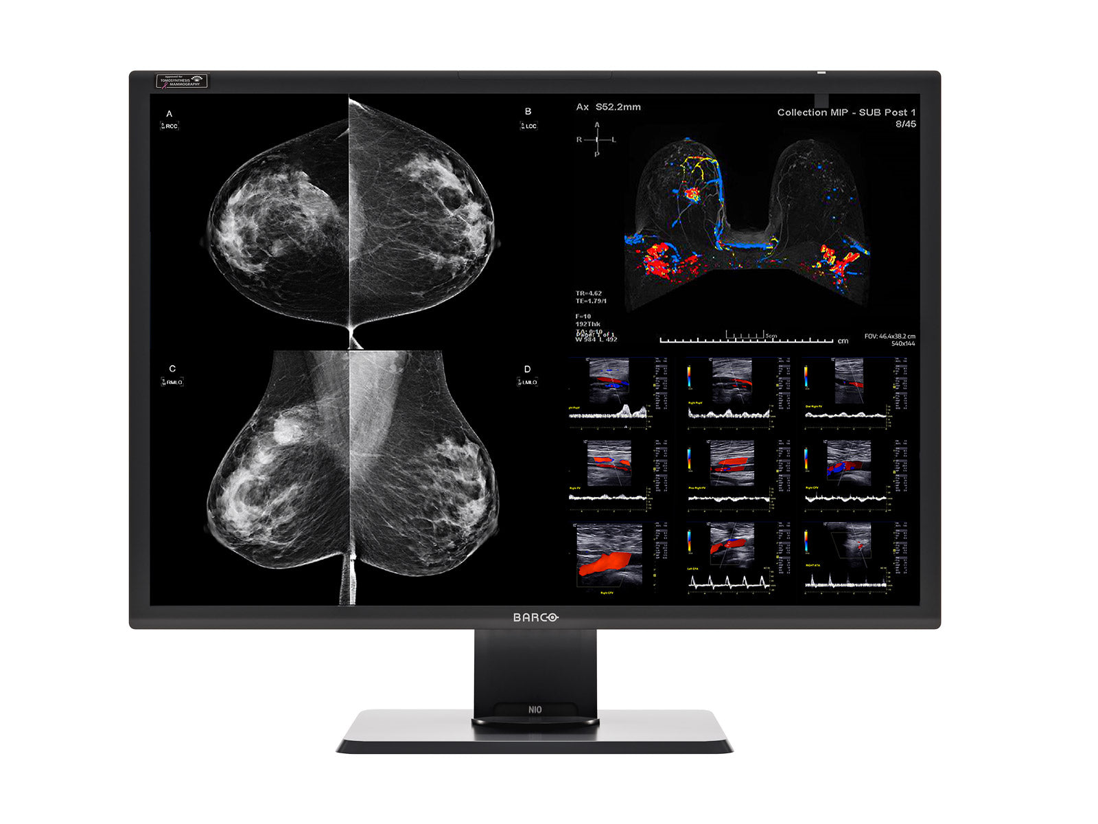 Complete Mammography Reading Station | Barco 12MP Color | HP Z4 G5 Workstation | Dictation Mic | Worklist Monitors (12130Z4G5)