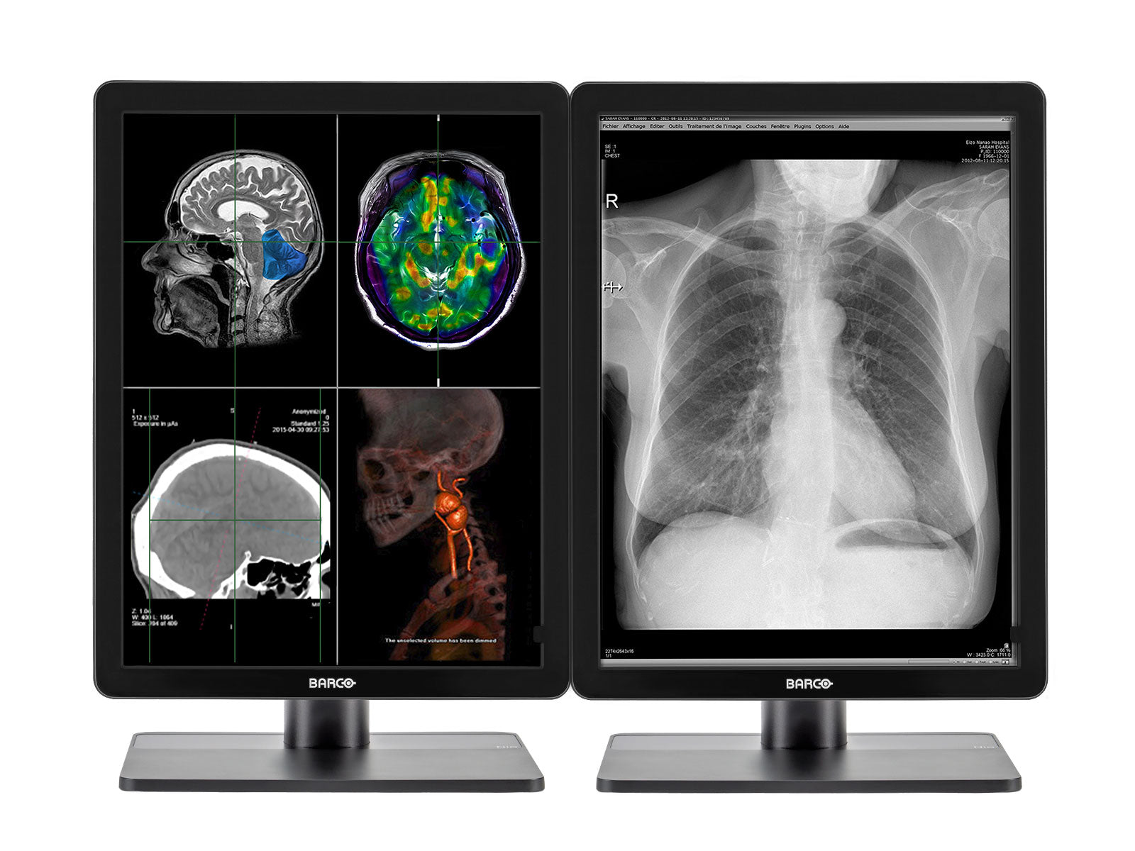 Barco Complete PACS General Radiology Station | HP Workstation