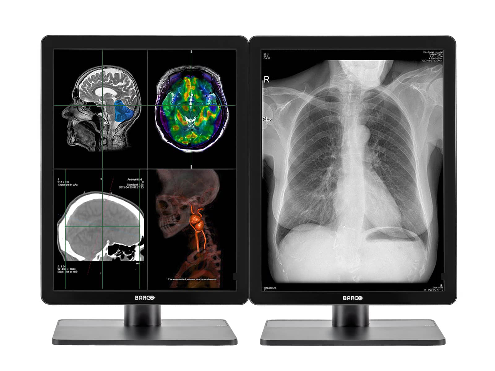 Barco Nio MDNC-3321 3MP 21" Color LED General Radiology Diagnostic PACS Display (Copy) Monitors.com 