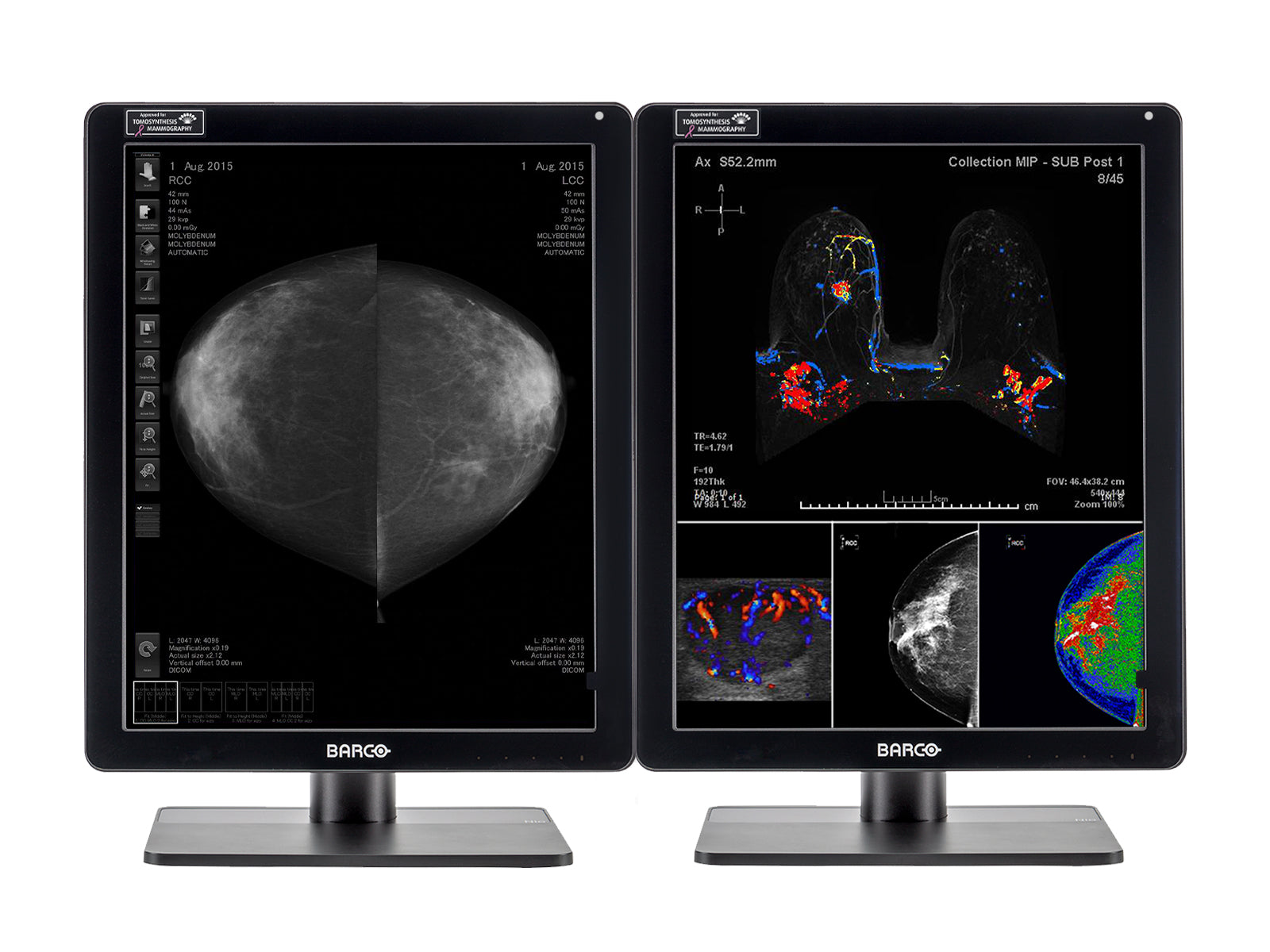 Complete Mammography Reading Station | Barco 5MP Color LED Monitor | HP Z4 G5 Workstation | Dictation Mic | Worklist Monitors (61212221)