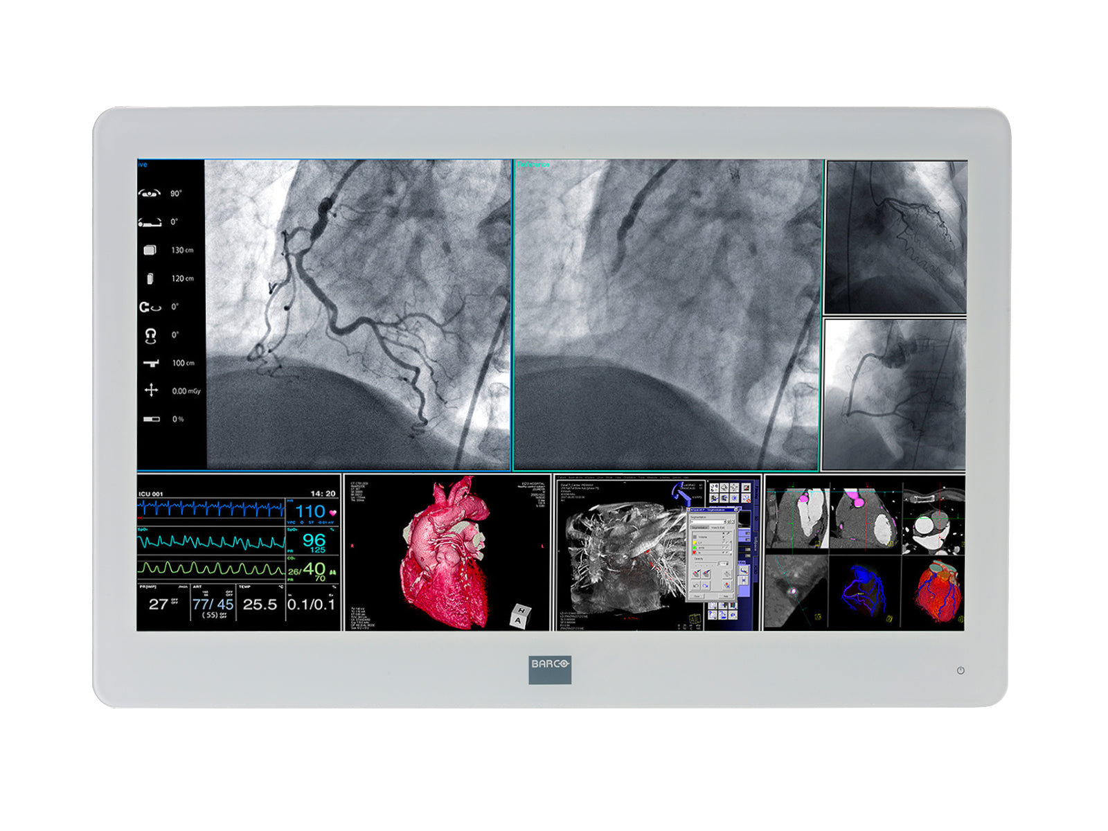 Barco MDSC-2226 LED 26" 2MP Full HD Color Surgical Medical Display Monitor (K9307906)