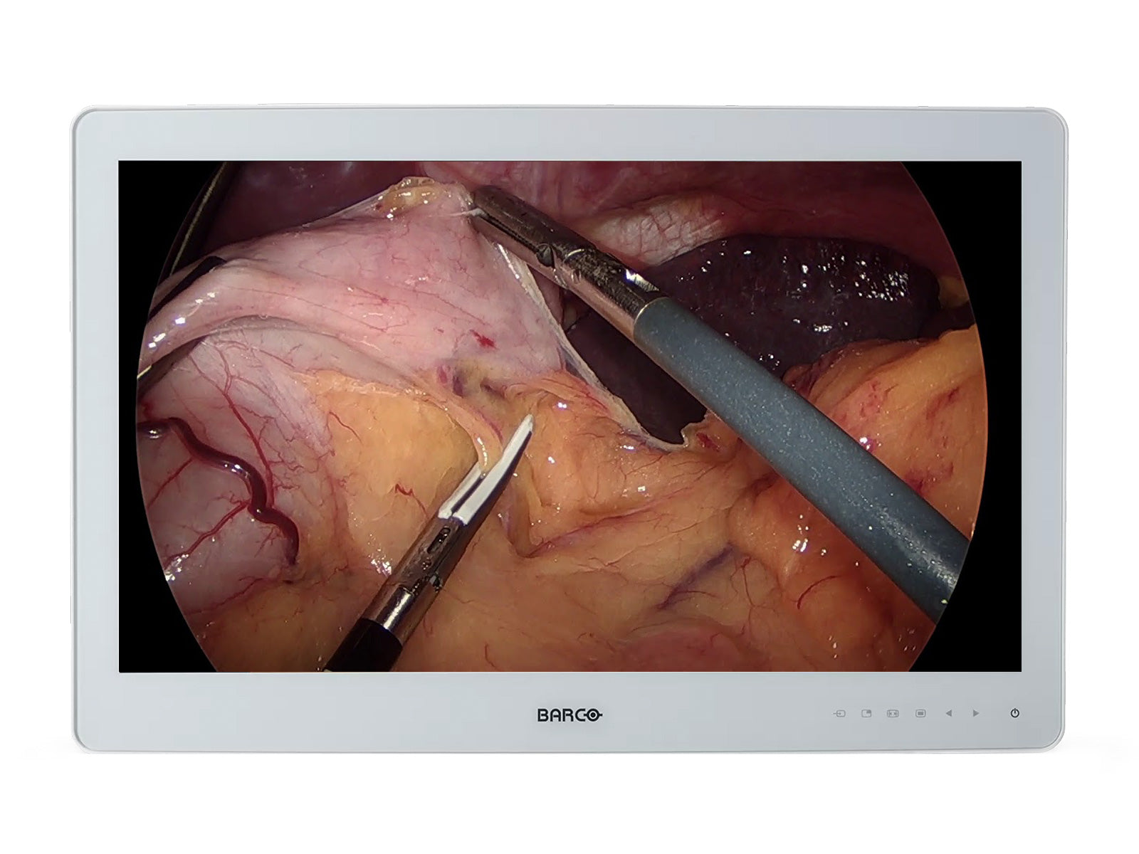 Barco MDSC-2326 26" 2MP Full HD Color Surgical Medical Display Monitor (K9307952)