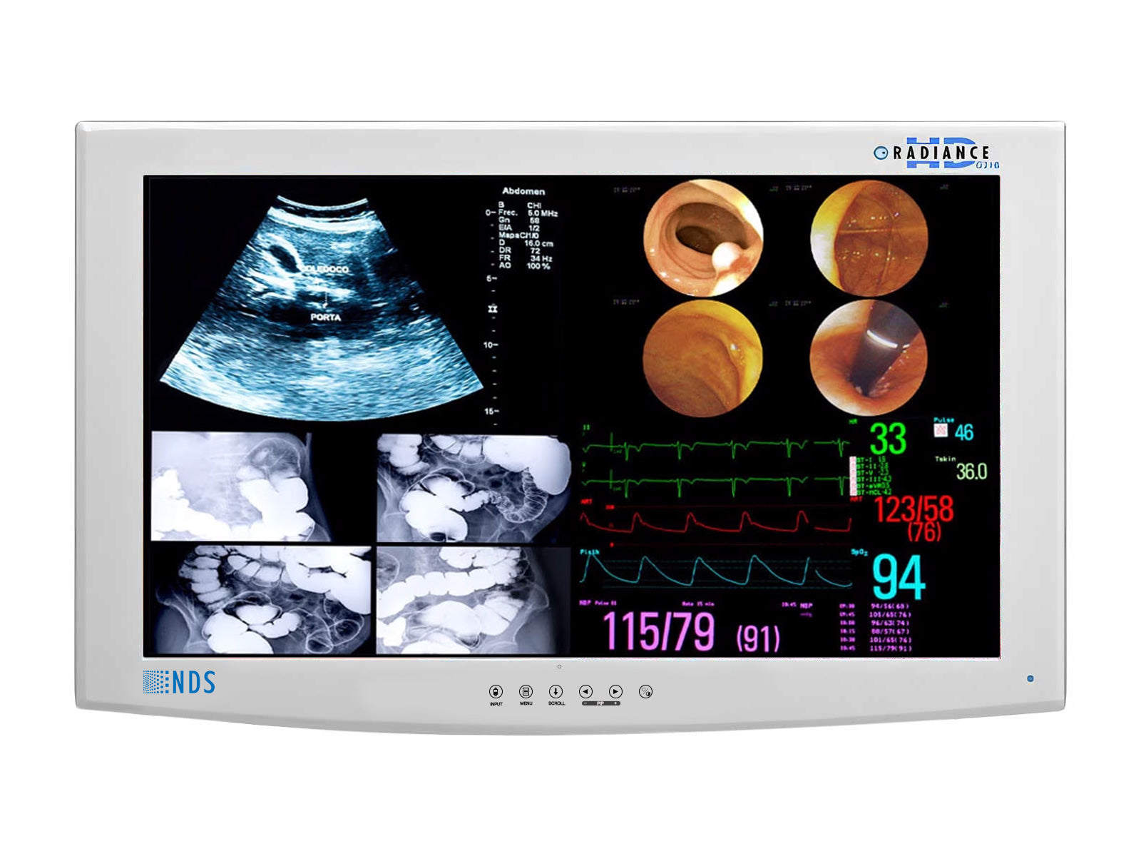 NDS Radiance SC-WU24-A1511 24" HD Surgical Display Monitor (SC-WU24-A1511)