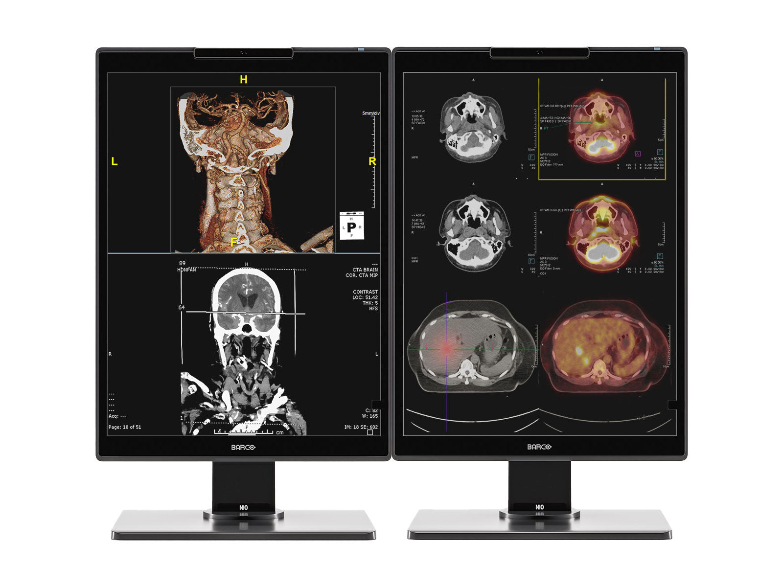 Barco Nio MDNC-3521 3MP 21" Color LED PACS Diagnostic Radiology Display Monitor Monitors.com 