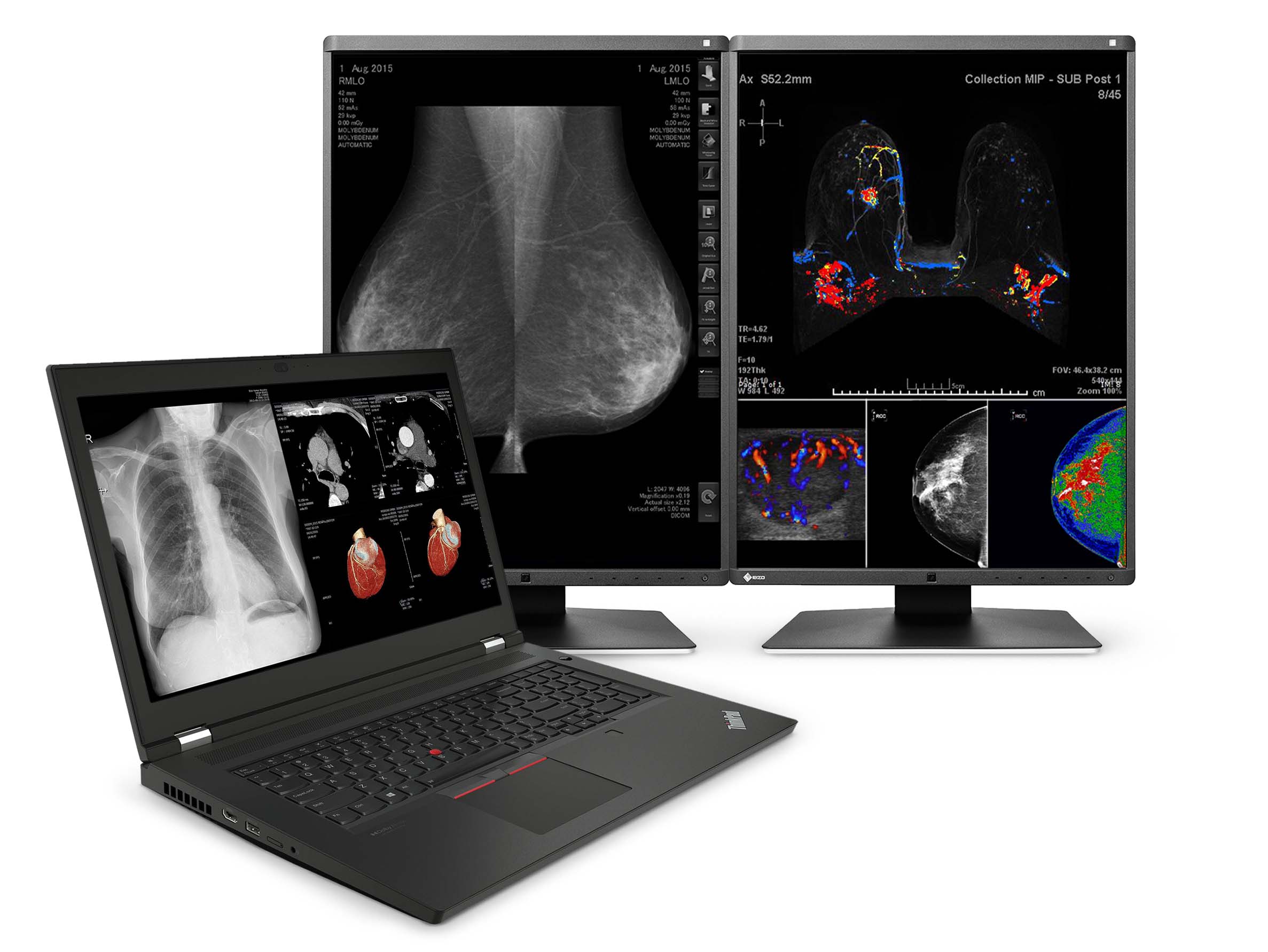 Lenovo ThinkPad P17 G2 Mobile Radiology Workstation | 17.3" 8MP DICOM Calibrated | Intel Core -i7-11850H @ 4.80GHz | 128GB DDR4 | 1TB NVMe SSD | NVIDIA RTX A5000 16GB | Win10 Pro Monitors.com 