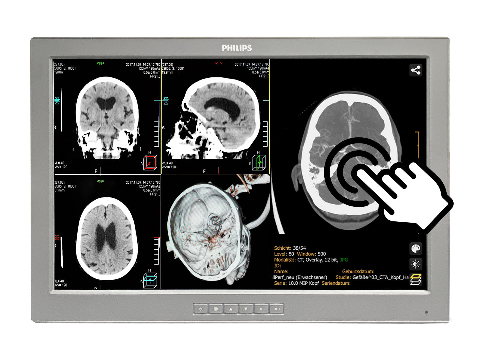 Barco P240-LTv Touchscreen MED24ESB 24" 2MP Philips DICOM (P240-LTv)