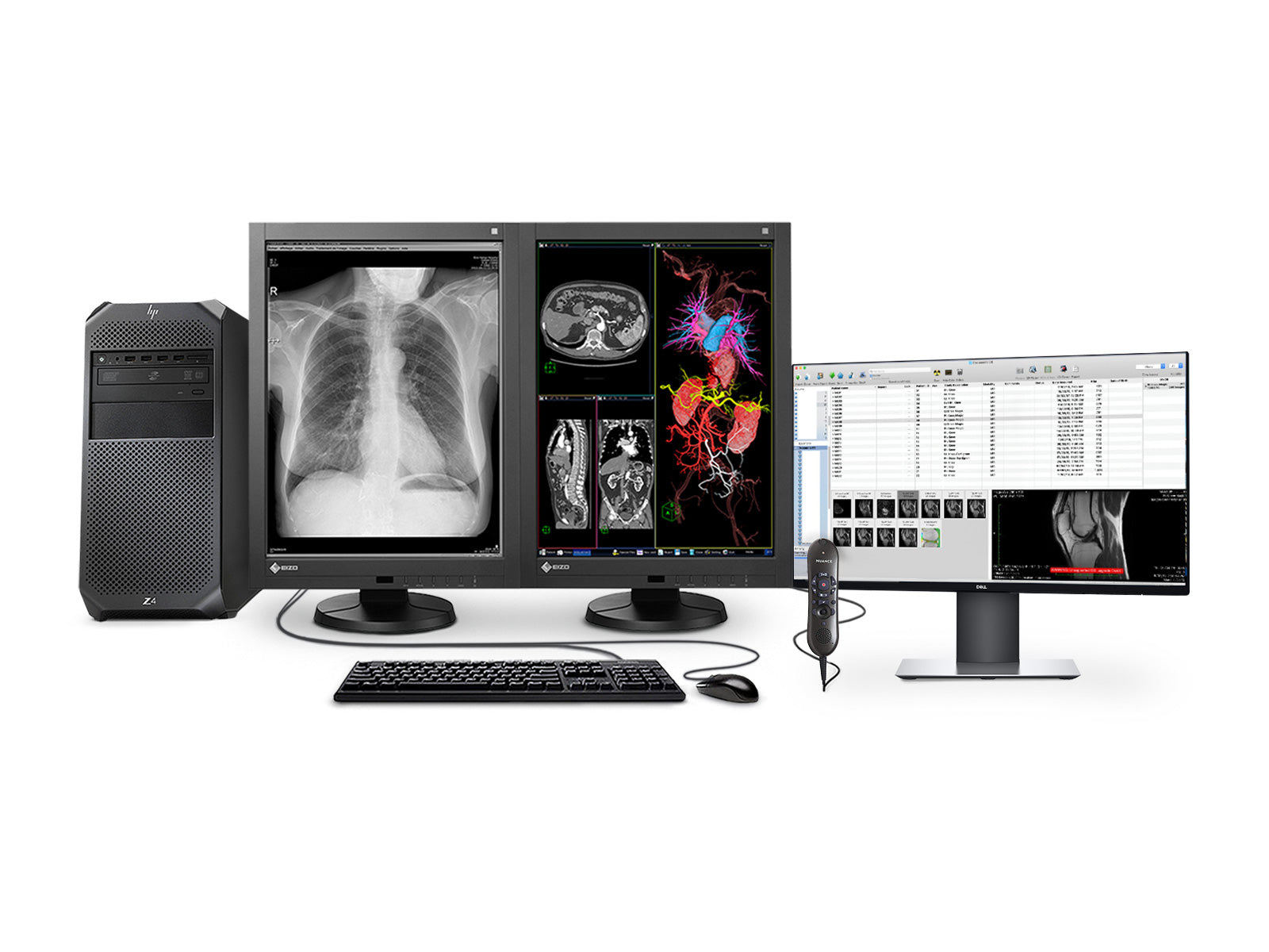 Complete PACS General Radiology Station | Eizo | HP Workstation