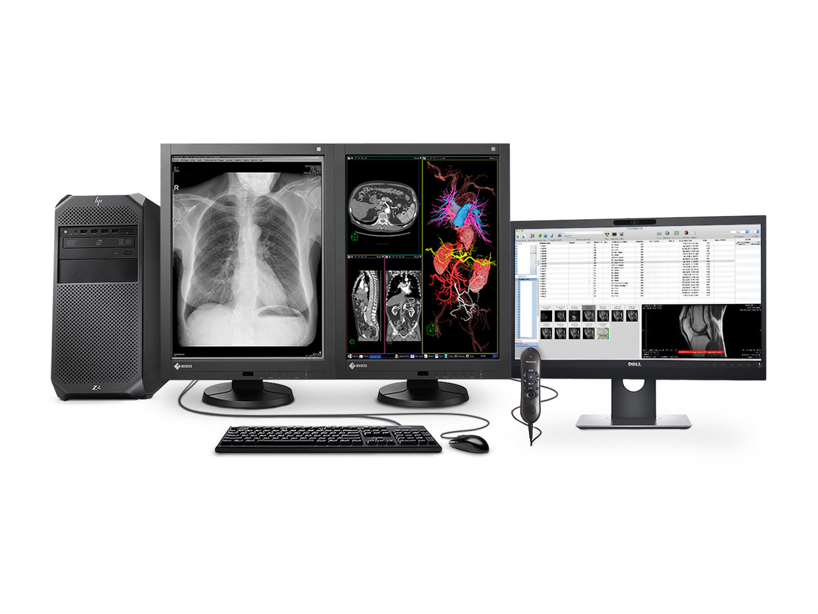 Complete PACS General Radiology Station | Eizo | HP Workstation