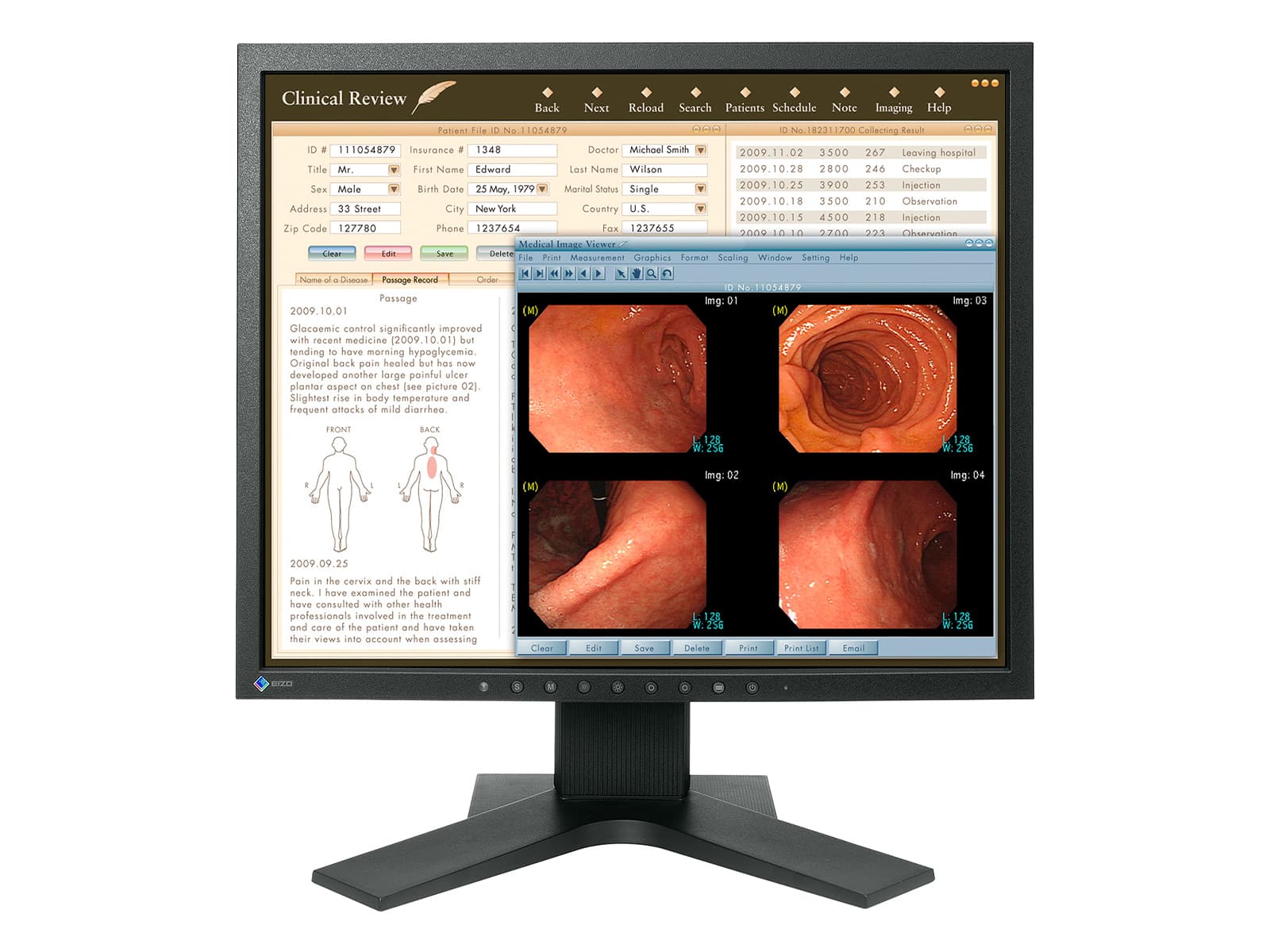 Eizo RadiForce MX192 1MP 19" Color LCD Clinical Review Monitor (0FTD2046)