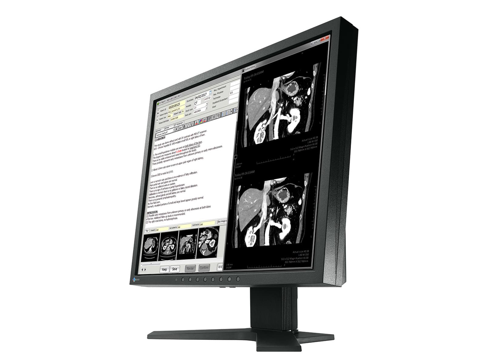 Eizo RadiForce MX192 1MP 19" Color LCD Clinical Review Monitor (0FTD2046)