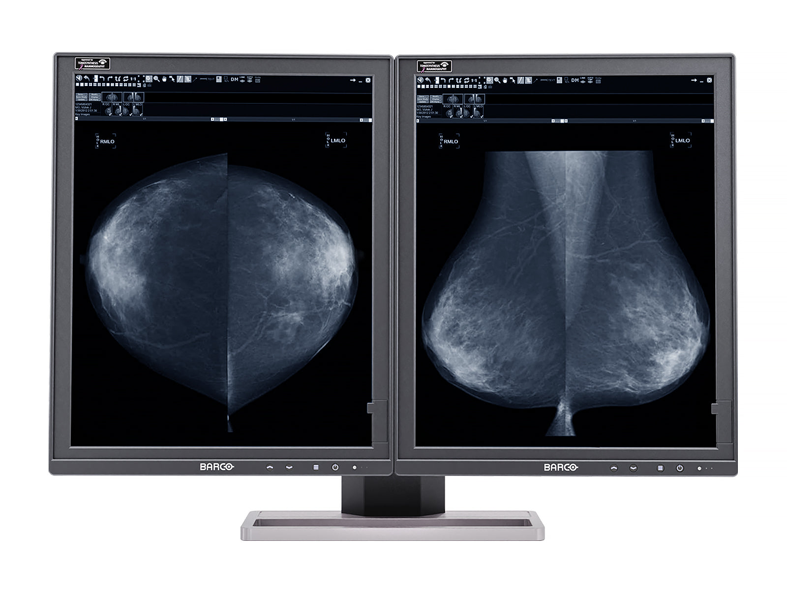 Complete Mammography Reading Station | Barco 5MP Grayscale LED Monitor | Lenovo Workstation | Dictation Mic | Worklist Monitors (5221Z42221)