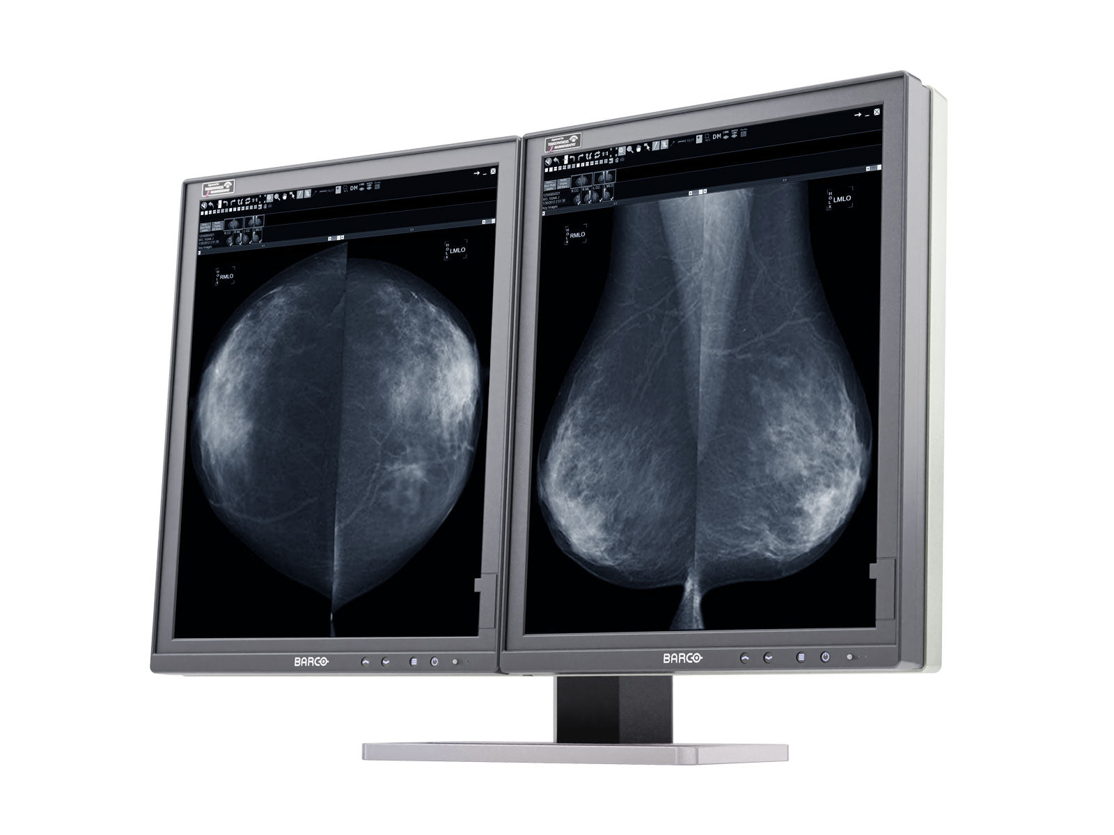 Barco Coronis MDMG-5221 5MP 21" Grayscale Tomosynthesis LED 3D-DBT Mammography Display Monitors.com 