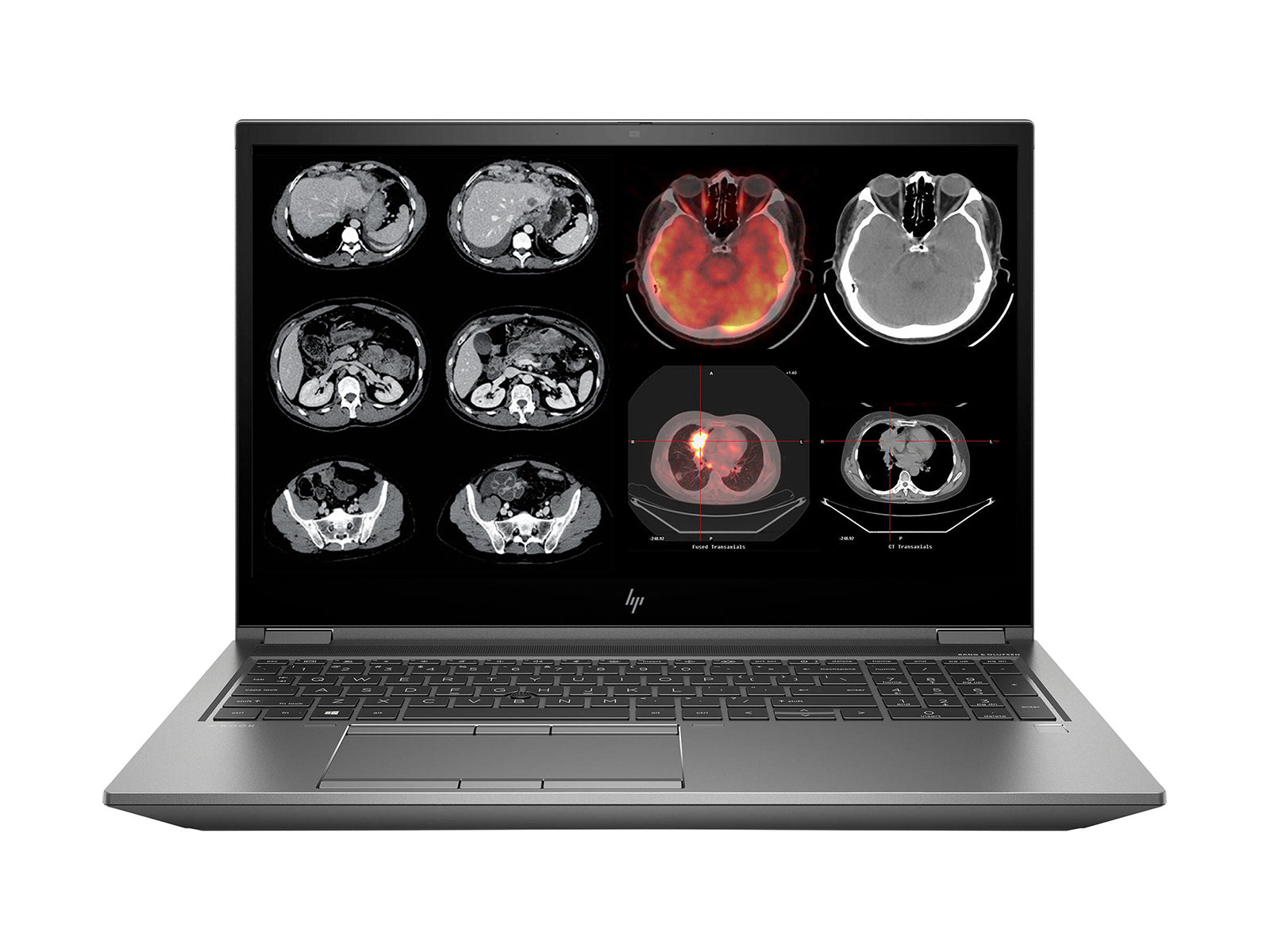 HP ZBook 15 G7 Mobile Radiology Workstation | 15.6" Full HD LED | Core i9-10885H @ 5.30GHz | 8-Core | 32GB DDR4 | 512GB NVMe SSD | Quadro RTX 3000 6GB | Win10 Pro Monitors.com 