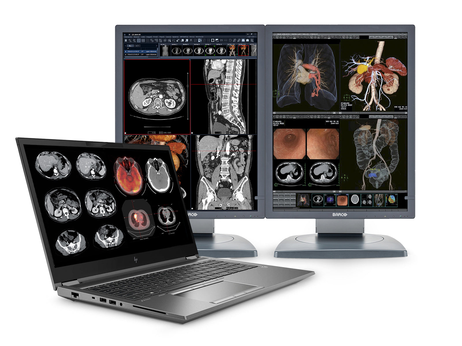 HP ZBook Fury 15 G8 Mobile Radiology Workstation | 15.6" 4K LED | Core i7-11850H @ 4.80GHz | 8-Core | 64GB DDR4 | 1TB NVMe SSD | Quadro RTX A3000 8GB | Win11 Pro Monitors.com 