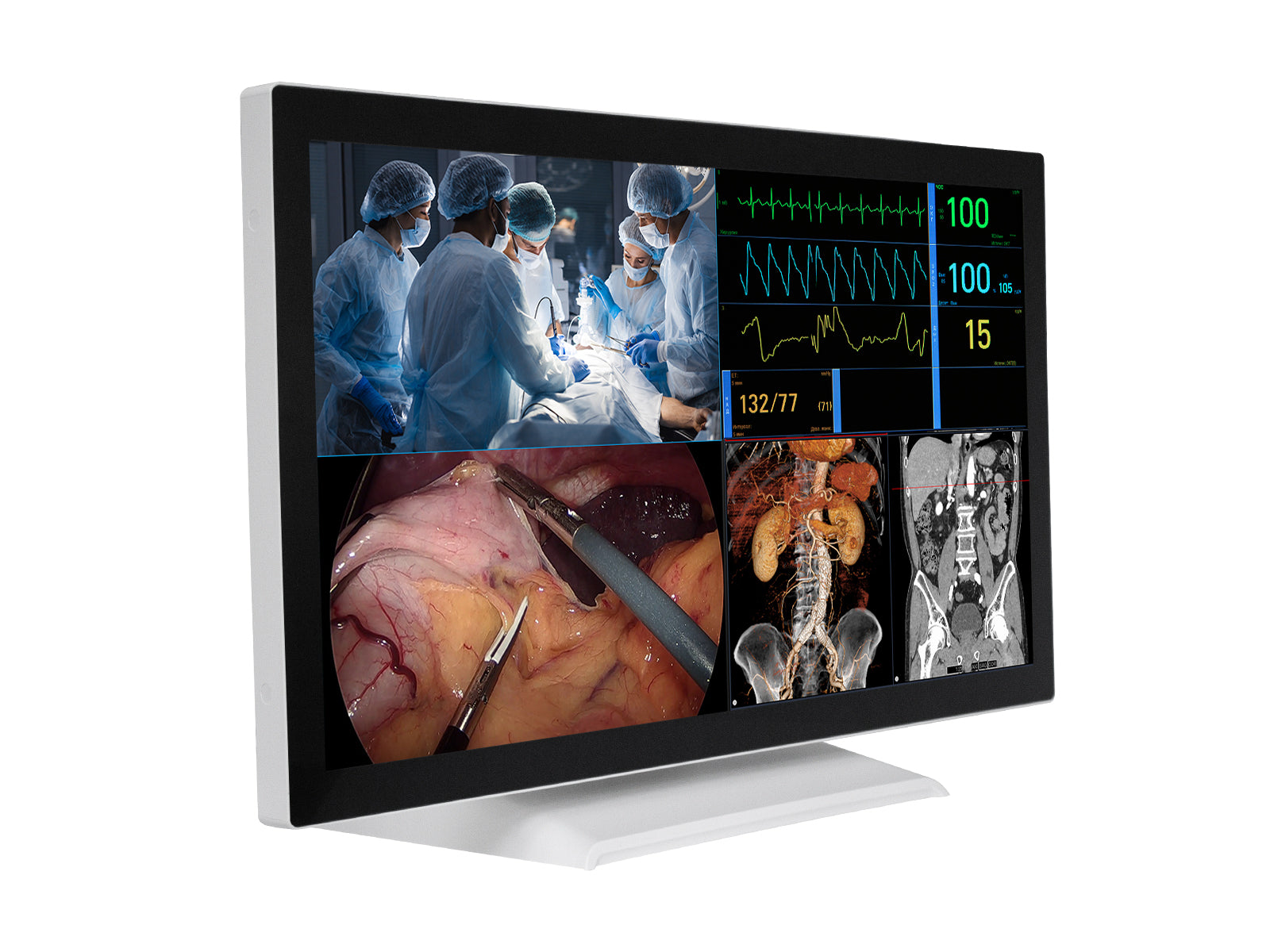 Barco AMM 215WTTP 21.5" Full HD Touchscreen Color Clinical Review Display Monitor Monitors.com 