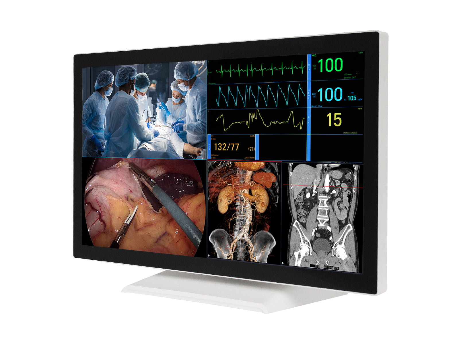 Barco AMM 215WTTP 21.5" Full HD Touchscreen Color Clinical Review Display Monitor Monitors.com 