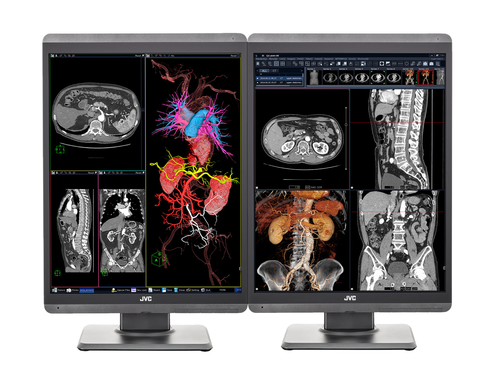 JVC Totoku CL-R211 2MP 21" Color Clinical Review Display Monitor (CL-R211) Monitors.com 