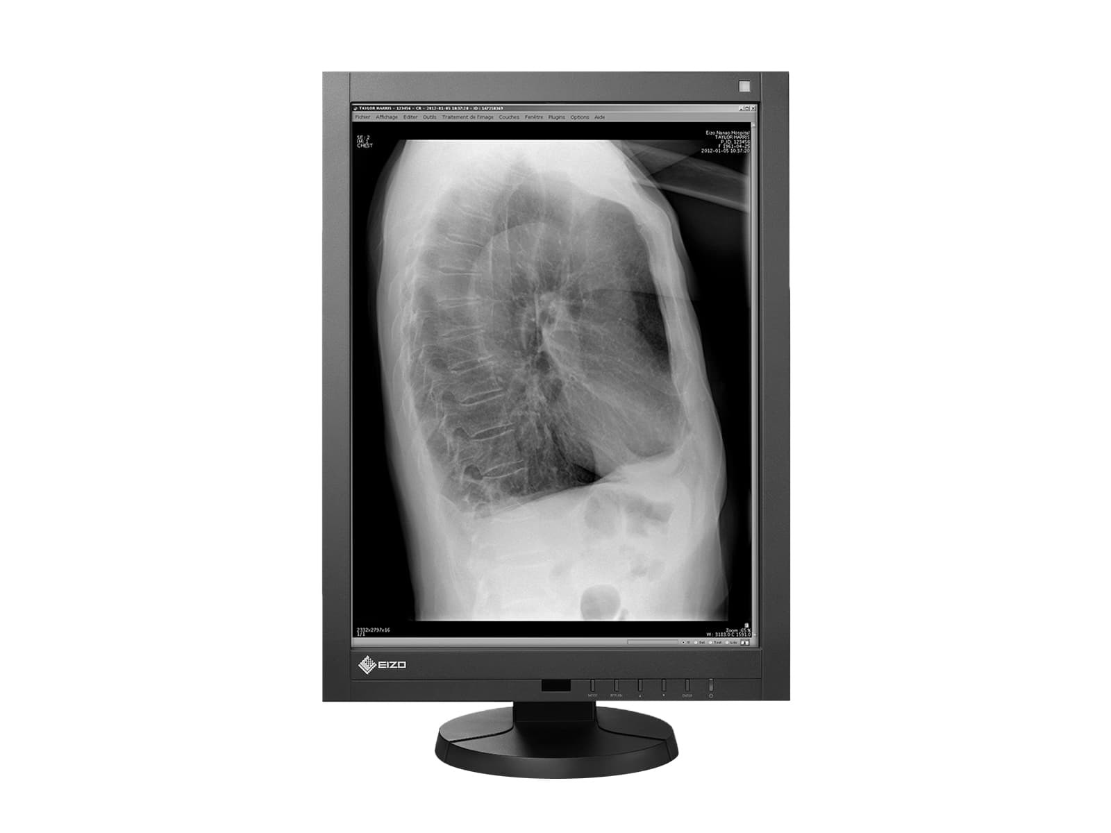 Eizo Radiforce GX240 21" 2MP Grayscale LED PACS Display Monitor (GX240) Monitors.com 