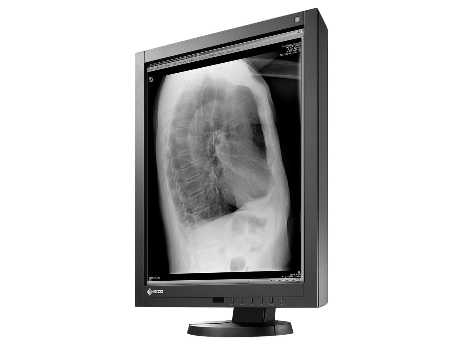 Eizo Radiforce GX240 21" 2MP Grayscale LED PACS Display Monitor (GX240) Monitors.com 