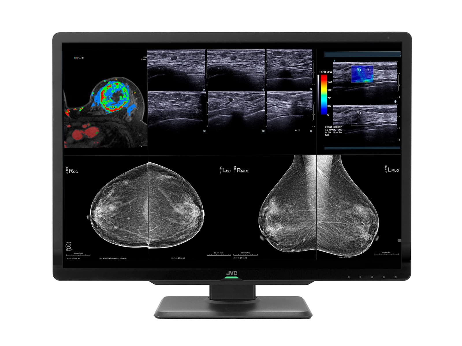 Complete Mammography Reading Station | JVC Totoku 12MP Color Display | HP Z4 G5 Workstation | Dictation Mic | Worklist Monitors (CLS1200Z4G5)