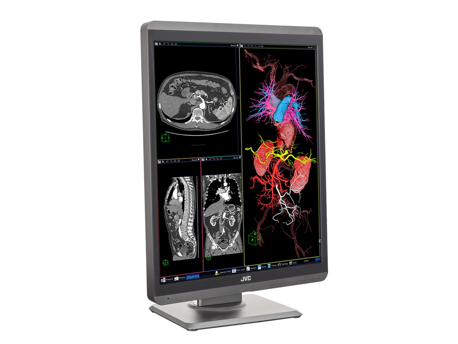 JVC Totoku CL-S300 3MP 21" Color LED General Radiology Diagnostic Display Monitors (CL-S300) Monitors.com 