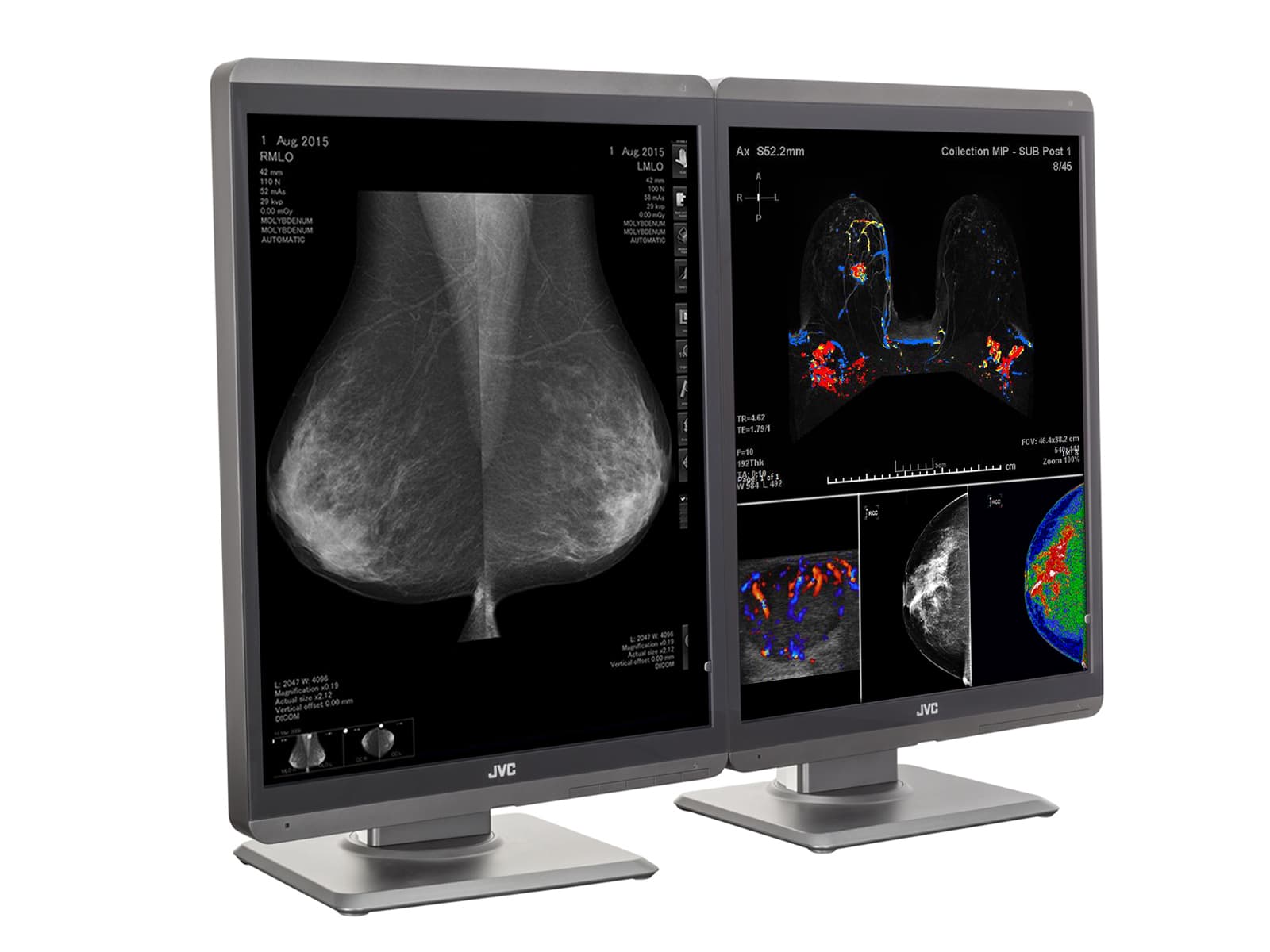 JVC Totoku CL-S500 5MP 21" Color LED Mammo 3D-DBT Breast Imaging Display (CL-S500) Monitors.com 