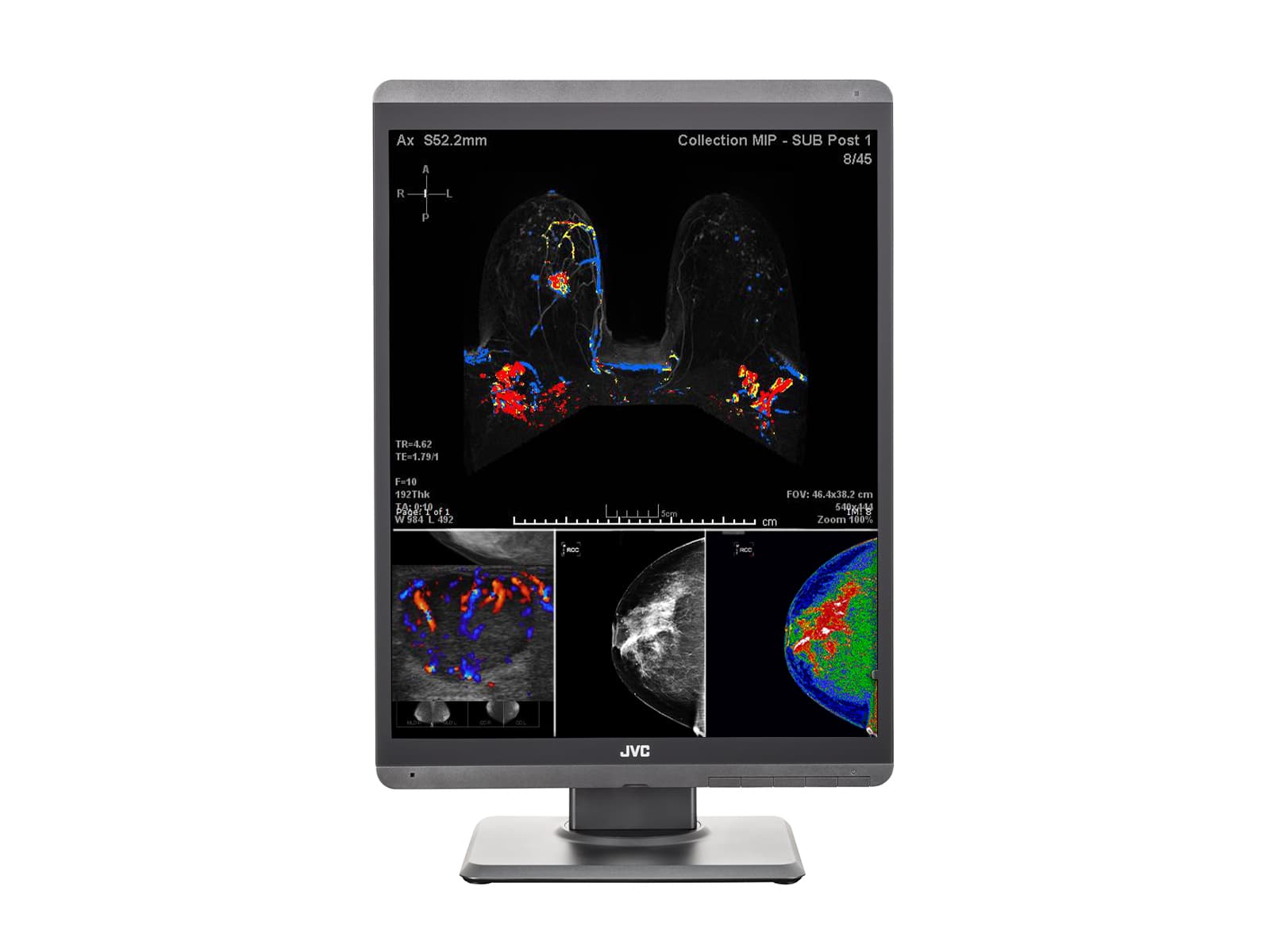 JVC Totoku CL-S500 5MP 21" Color LED Mammo 3D-DBT Breast Imaging Display (CL-S500) Monitors.com 