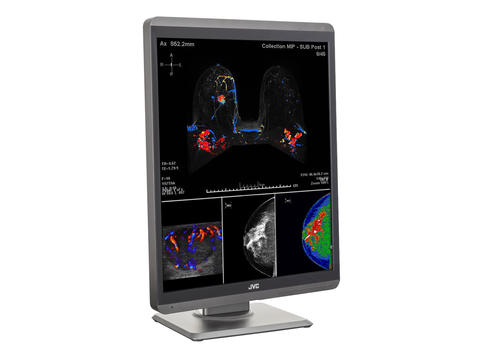 JVC Totoku CL-S500 5MP 21" Color LED Mammo 3D-DBT Breast Imaging Display (CL-S500) Monitors.com 